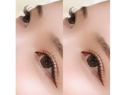 リリー(LILY)の写真