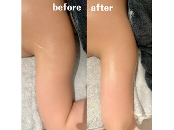 グレアージュ(GLEAGE)/