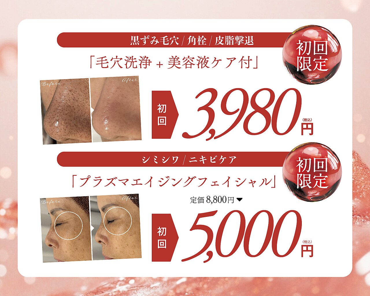 フェイシャルボーテ カシェボーテ(CACHE BEAUTE)｜ホットペッパービューティー