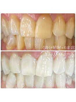 ホワイトニングルーム 横浜店(Whitening Room)/セルフホワイトニング/横浜