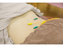 越谷駅前鍼灸整骨院の雰囲気（身体の反応を診ながら整える鍼施術。初めての方にもオススメです）