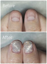 アウラ ネイル ファクトリー(aura nail factory)/深爪矯正(長さだし)マグネット