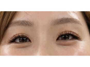 エシア(ECIA)/エク×パーマ★アンドヘルシー