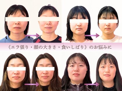 ハル(haru.)の写真
