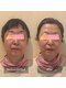 ソリス(solis)の写真/【透明感あふれる水光肌へ】くすみの原因となる古い角質を徹底除去し、疲れ顔を撃退して瑞々しい素肌に。 