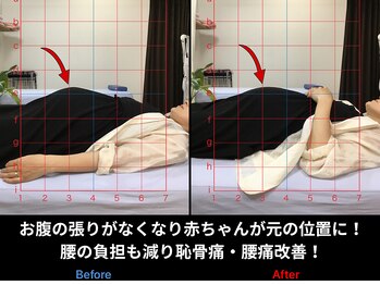 岳鍼灸整骨院の写真/子連れOKの完全プライベート空間でマタニティ整体。腰痛や逆子の悩みに寄り添う◎
