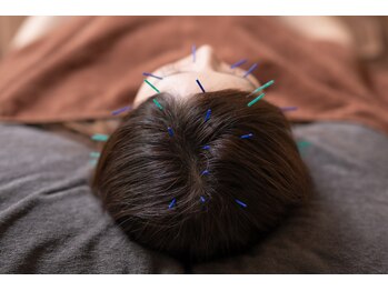ゆるの写真/つらい不調を、鍼灸で根本からケア