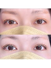 フィール(feel)/マシュマロッド