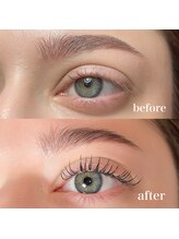 ジェーズビューティー(J's beauty)/before ＆ after