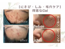 シエル(Ciel)
