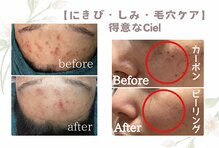 シエル(Ciel)