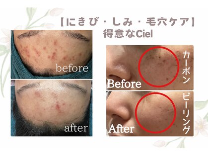 シエル(Ciel)の写真