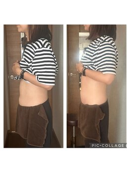 絢香/腸もみ1回ビフォアフター