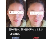 美容矯正サロン レレポノ(LELEPONO)/
