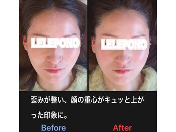 美容矯正サロン レレポノ(LELEPONO)/