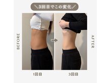 ハームス 桂店(HAARMS)の雰囲気（【腸もみ&よもぎ蒸しのセットメニューが1番人気！！】）