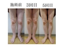 そらのいえの雰囲気(優しいタッチでリンパを流してリラックスしながらむくみスッキリ)