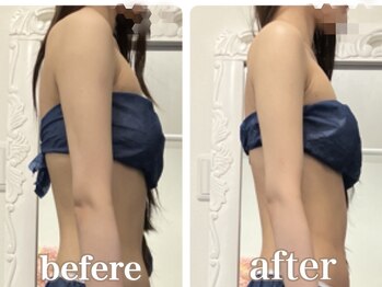 プリンセス ボディの写真/〈骨格調整×痩身〉最強の組合せで40代から増加する老け見え原因【背肉・二の腕・脇肉・太い首】全て撃退！