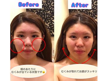 アジール 長岡リバーサイド千秋店(agir)/Before/After画像