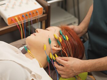 セットアップ鍼灸院(setup鍼灸院)/lift up美容鍼