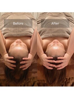 スリージー/before/after