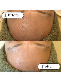 トータルビューティーサロンリア(Li'a)/ビフォー＆アフター