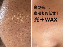 ママナ(mamana)の雰囲気（世界初の美肌になれる脱毛マシンとWAXで最後は毛穴レス♪）