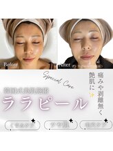 ビヨウイリョウテイケイ プリード(美容医療提携 PULIDO）)/ララピール初回9800円