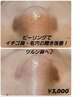 【イチゴ鼻、毛穴の開きにお悩みの方！】ピーリングでツルすべ鼻に♪￥3,000