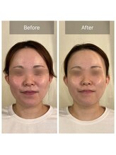 マシェリ(ma cherie)/ララピール or セラピール？？