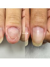 ジル(JiLL)/【自爪育成】