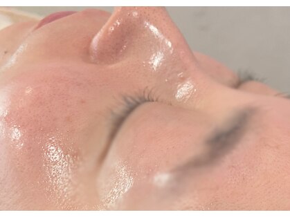 ビジ(biji)の写真