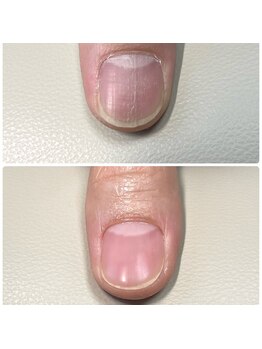 コーリン(Korin)の写真/《爪悩みはパラコーティングで解決》自爪を削らず健康な自爪風のナチュラルな美しさ！【初回クーポン有】
