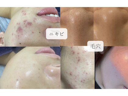 アリュール 京都烏丸御池店(ALLURE)の写真