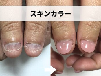ブルームーンネイルズ(BLOOMOON.nails)/スキンカラー