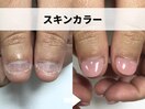 スキンカラー