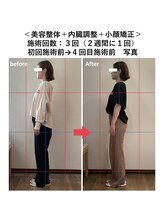 ぷめはな整体/美容整体+小顔矯正+内臓調整