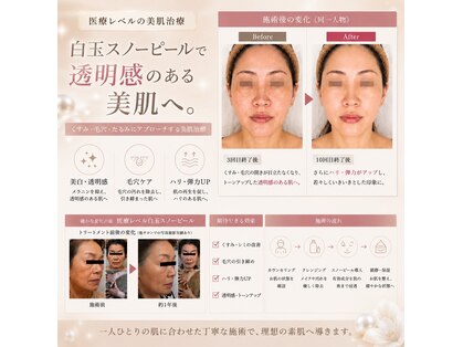 フローラの写真