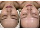 ウナ フェイシャル(una facial)の写真/肌質改善◆陶肌トリートメント「次世代ハーブピーリング」一度で確かな実感☆女優さんの様な輝くオーラ肌へ