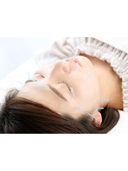 鍼灸施術を受けたい