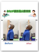 おなが浦添当山整骨院/頚の特別施術＆全身調整