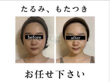 キュープ 浜松店(Qpu)の雰囲気（女性のための女性による小顔美容矯正専門店です！）