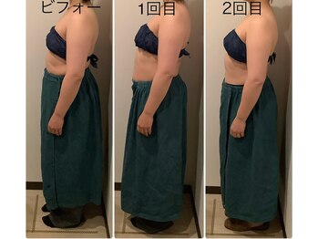 リズ(Liz)/光痩身 +ゲルマ温浴 +水素吸入