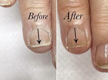 トゥインクリーネイルサロン(Twinkly Nail Salon)/【最強のネイルケア】1回お試し