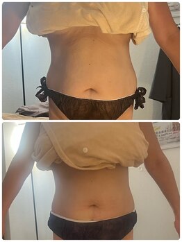 レア ルアン 西口店/復活の炭酸痩身大人気!