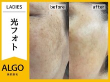 アルゴ 小松店(ALGO)/光フォト（50代女性）