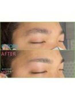 MDラボ 小松清六店/before after