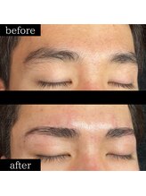 ユー 千葉駅前店(you)/症例写真