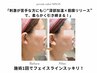【40・50代のたるみケア】むくみ・小顔・フェイスラインが気になる方