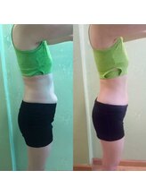 ラディアンス/貼るだけデトックス！